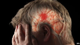 Illustration for article titled Obat Stroke Ajaib